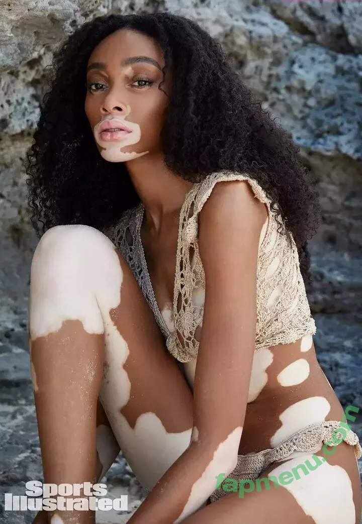 Winnie Harlow nude photo #0103 (winnieharlow)