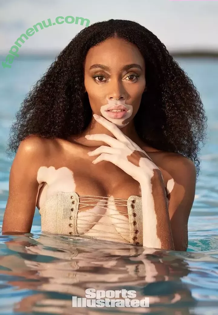 Winnie Harlow nude photo #0108 (winnieharlow)