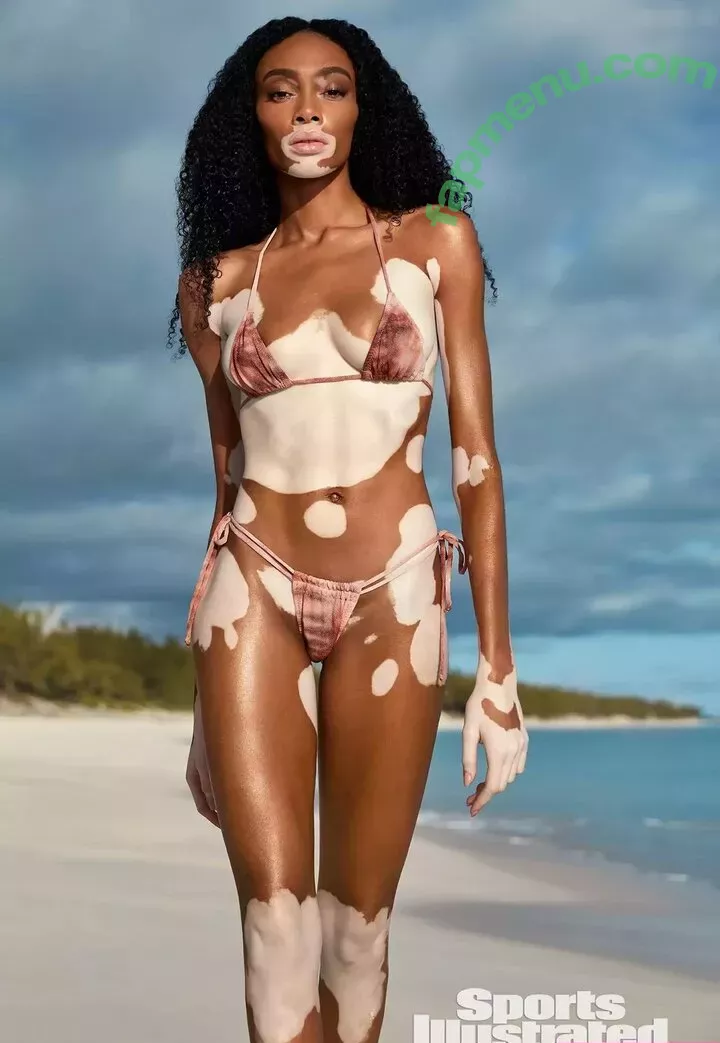 Winnie Harlow nude photo #0111 (winnieharlow)