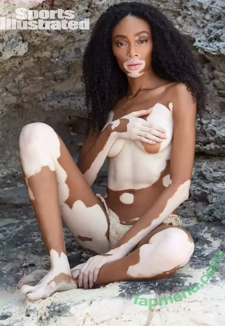 Winnie Harlow nude photo #0114 (winnieharlow)