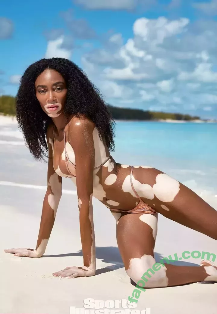 Winnie Harlow nude photo #0117 (winnieharlow)