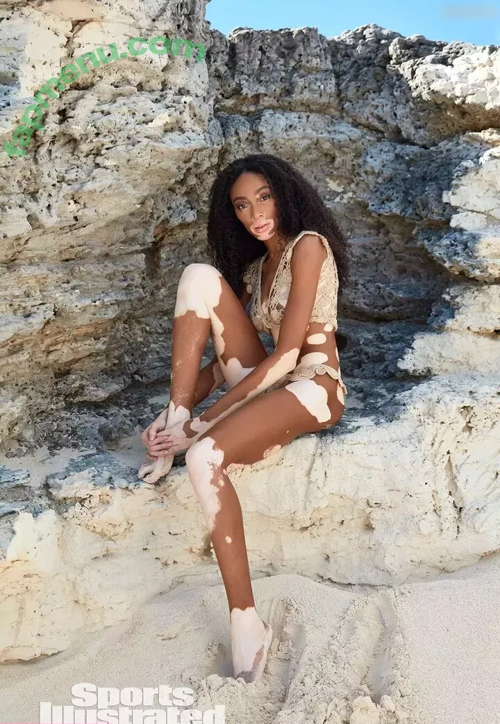 Winnie Harlow nude photo #0136 (winnieharlow)