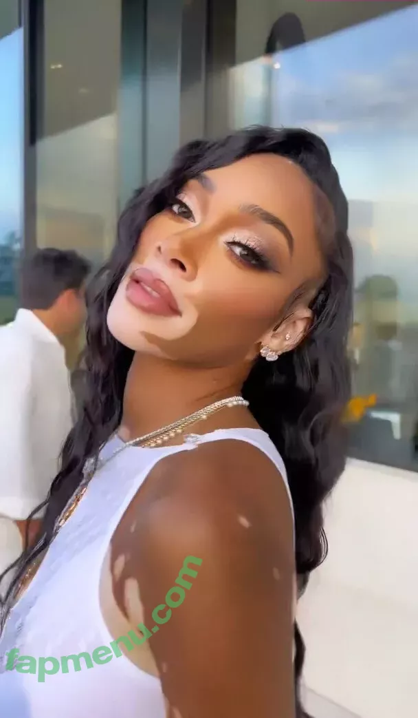 Winnie Harlow nude photo #0148 (winnieharlow)