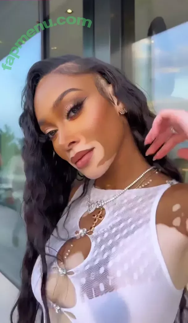 Winnie Harlow nude photo #0149 (winnieharlow)