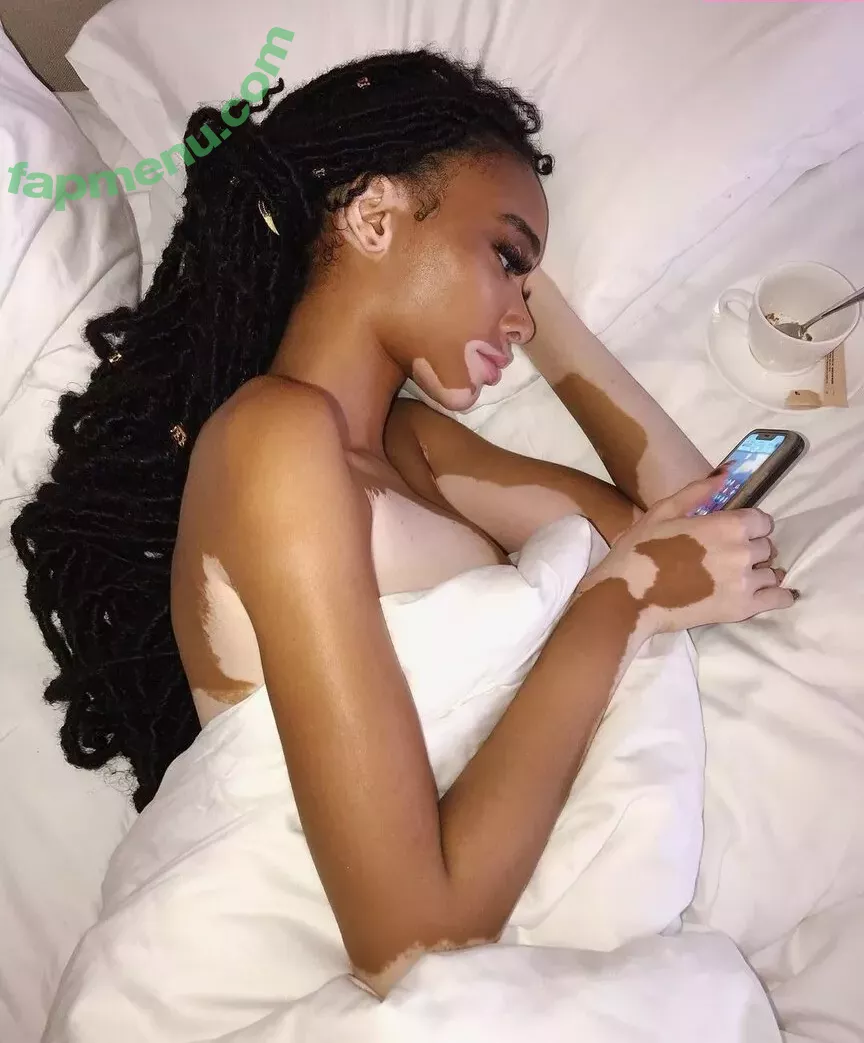 Winnie Harlow nude photo #0159 (winnieharlow)