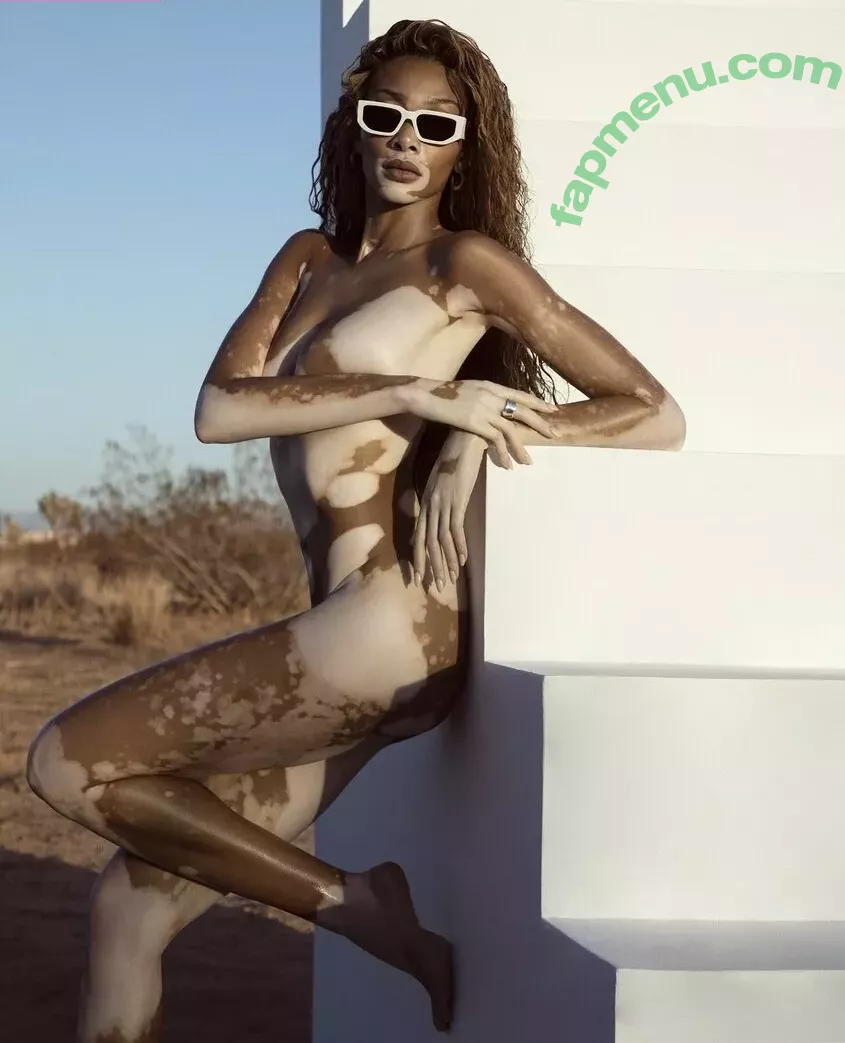 Winnie Harlow nude photo #0161 (winnieharlow)