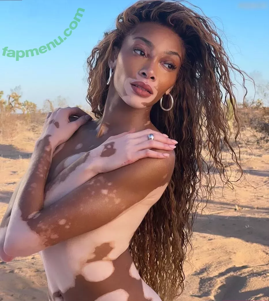 Winnie Harlow nude photo #0163 (winnieharlow)