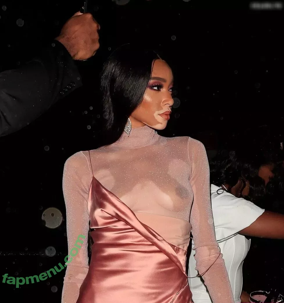 Winnie Harlow nude photo #0187 (winnieharlow)