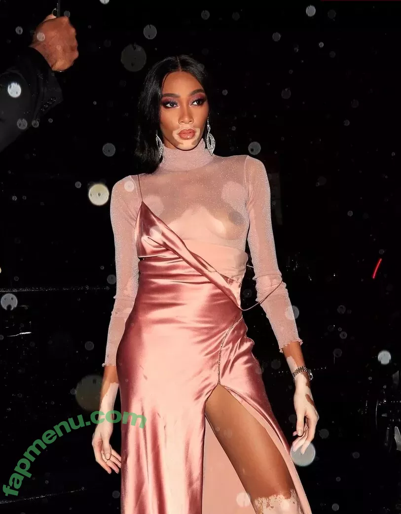 Winnie Harlow nude photo #0198 (winnieharlow)