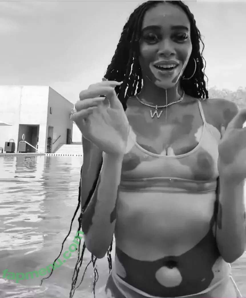 Winnie Harlow nude photo #0216 (winnieharlow)