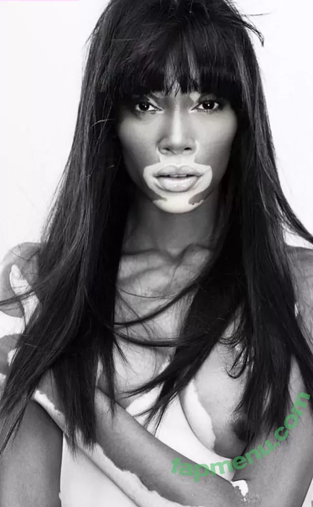 Winnie Harlow nude photo #0219 (winnieharlow)