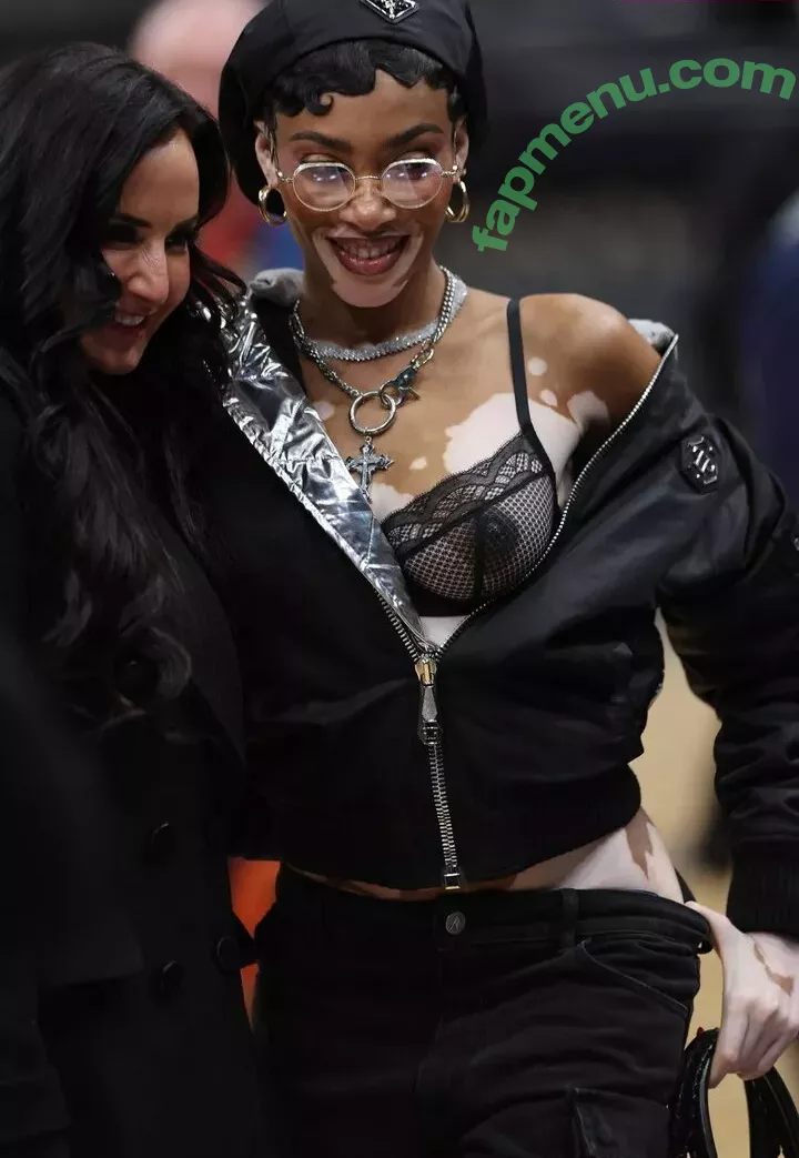 Winnie Harlow nude photo #0226 (winnieharlow)