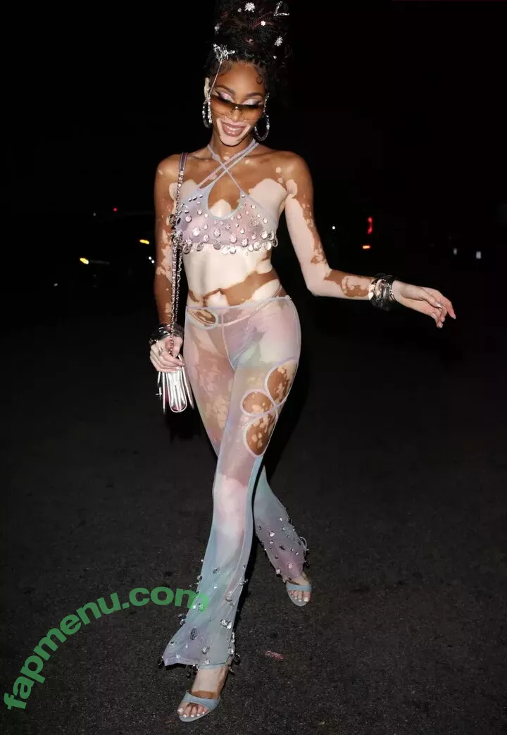 Winnie Harlow nude photo #0239 (winnieharlow)