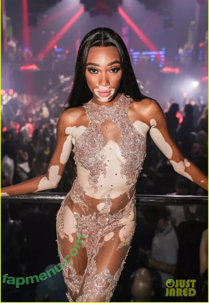 Winnie Harlow nude photo #0372 (winnieharlow)