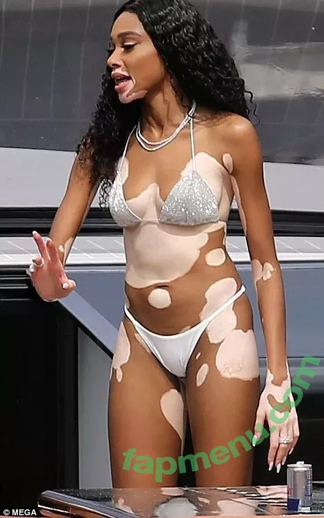 Winnie Harlow nude photo #0376 (winnieharlow)