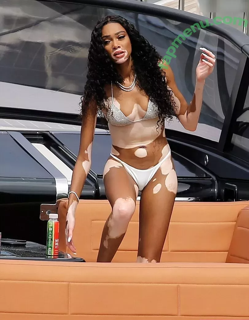 Winnie Harlow nude photo #0380 (winnieharlow)