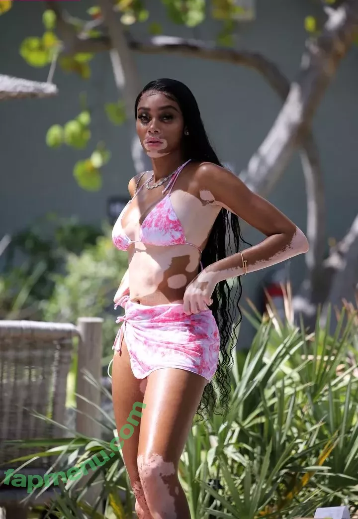 Winnie Harlow nude photo #0406 (winnieharlow)