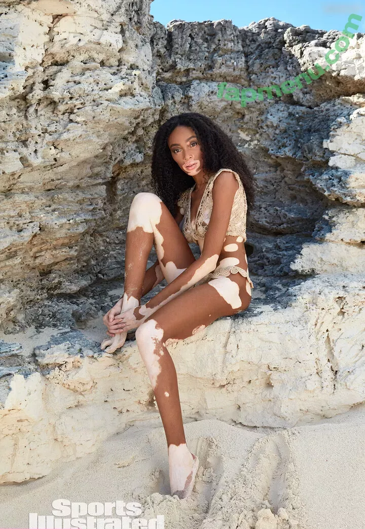 Winnie Harlow nude photo #0442 (winnieharlow)