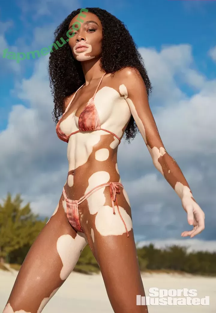 Winnie Harlow nude photo #0444 (winnieharlow)