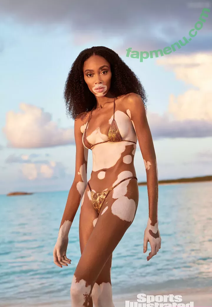 Winnie Harlow nude photo #0452 (winnieharlow)