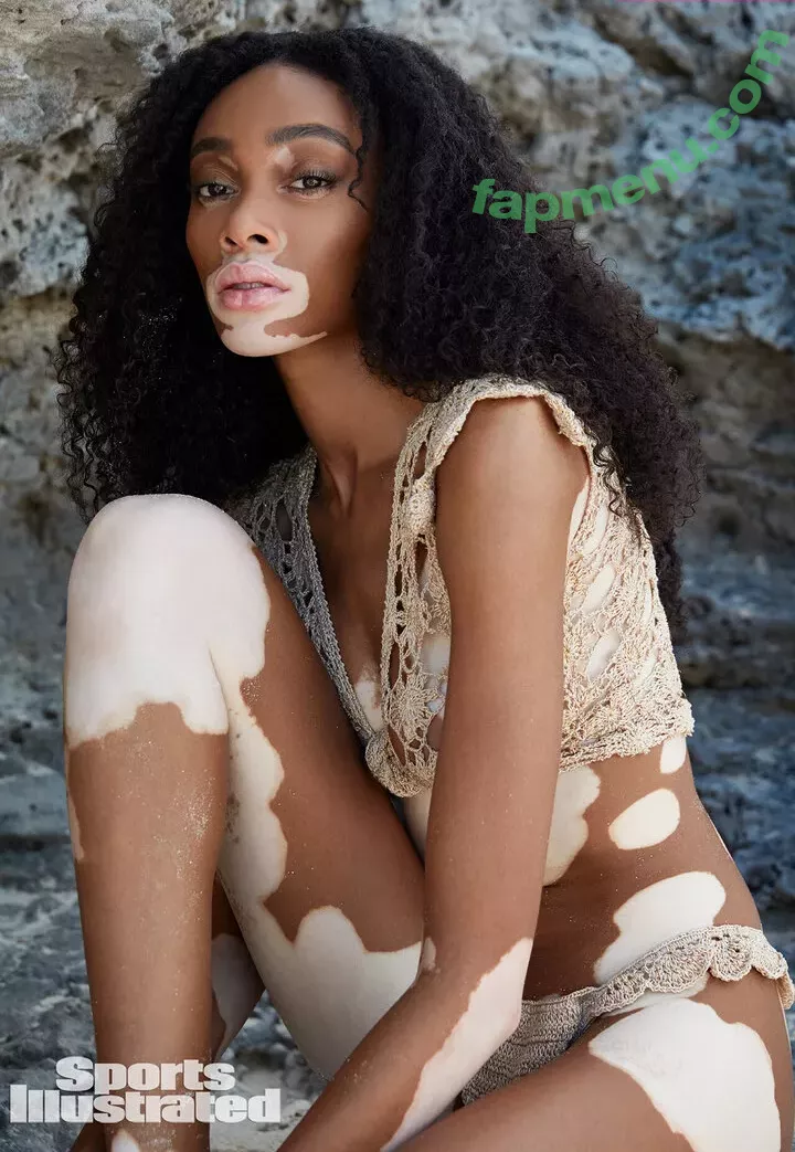 Winnie Harlow nude photo #0455 (winnieharlow)