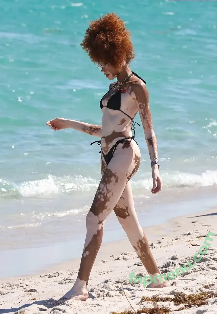 Winnie Harlow nude photo #0483 (winnieharlow)