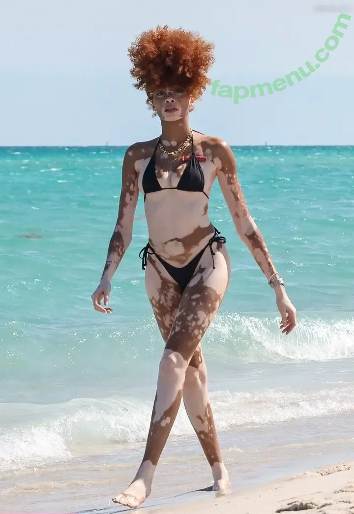 Winnie Harlow nude photo #0484 (winnieharlow)