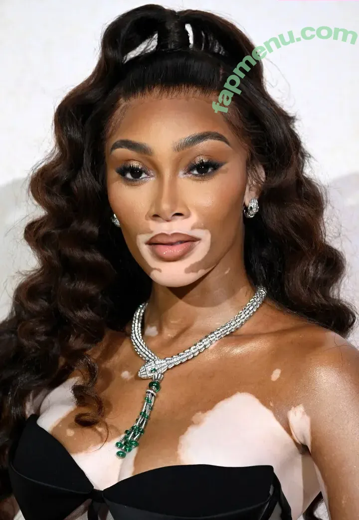 Winnie Harlow nude photo #0534 (winnieharlow)