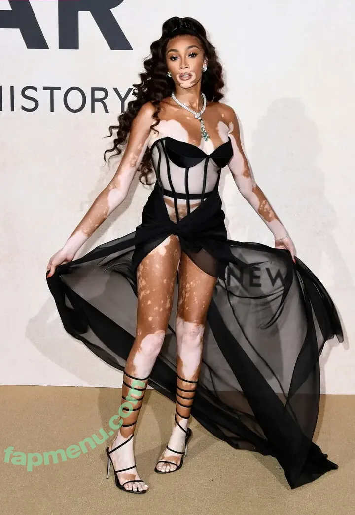 Winnie Harlow nude photo #0537 (winnieharlow)