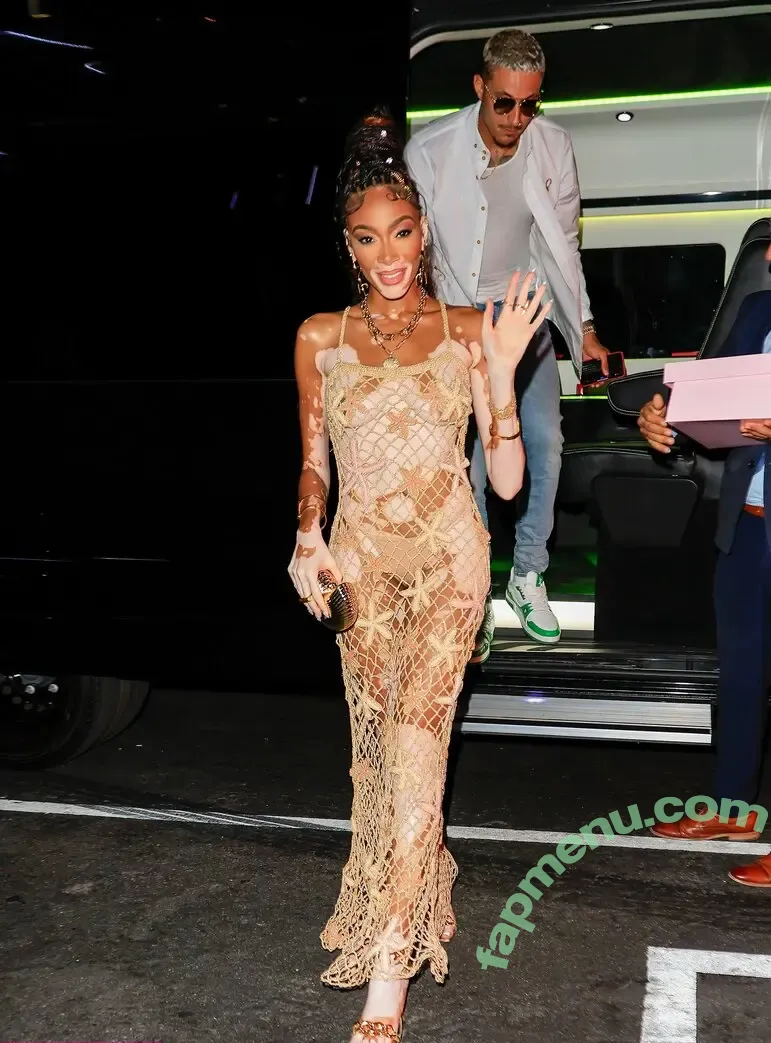 Winnie Harlow nude photo #0549 (winnieharlow)