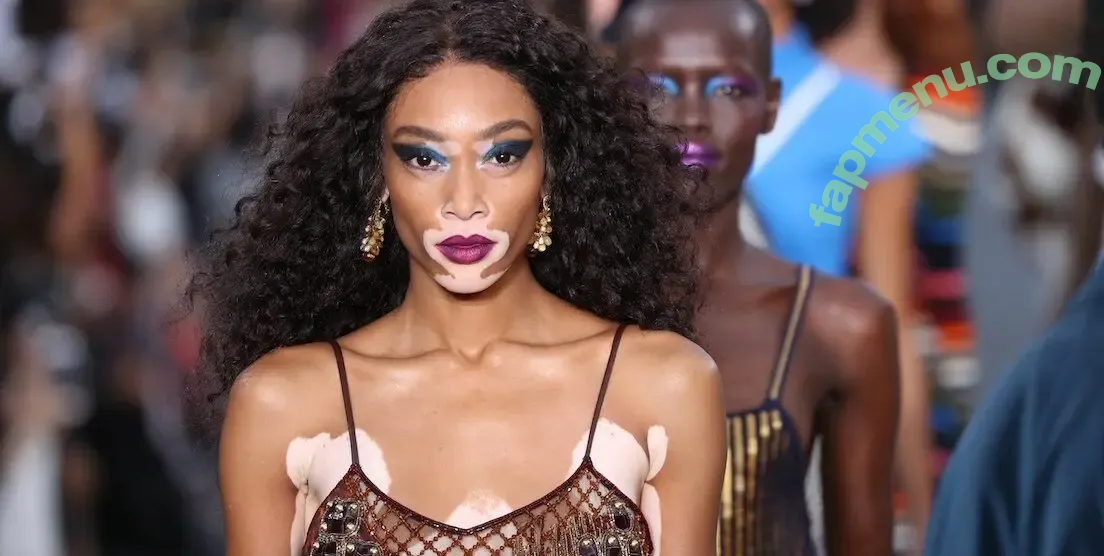 Winnie Harlow nude photo #0553 (winnieharlow)