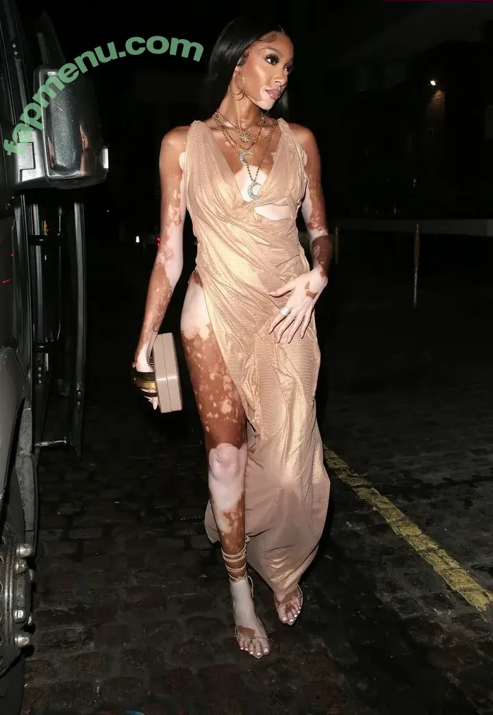 Winnie Harlow nude photo #0569 (winnieharlow)