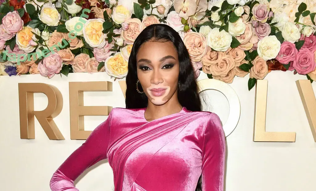 Winnie Harlow nude photo #0575 (winnieharlow)