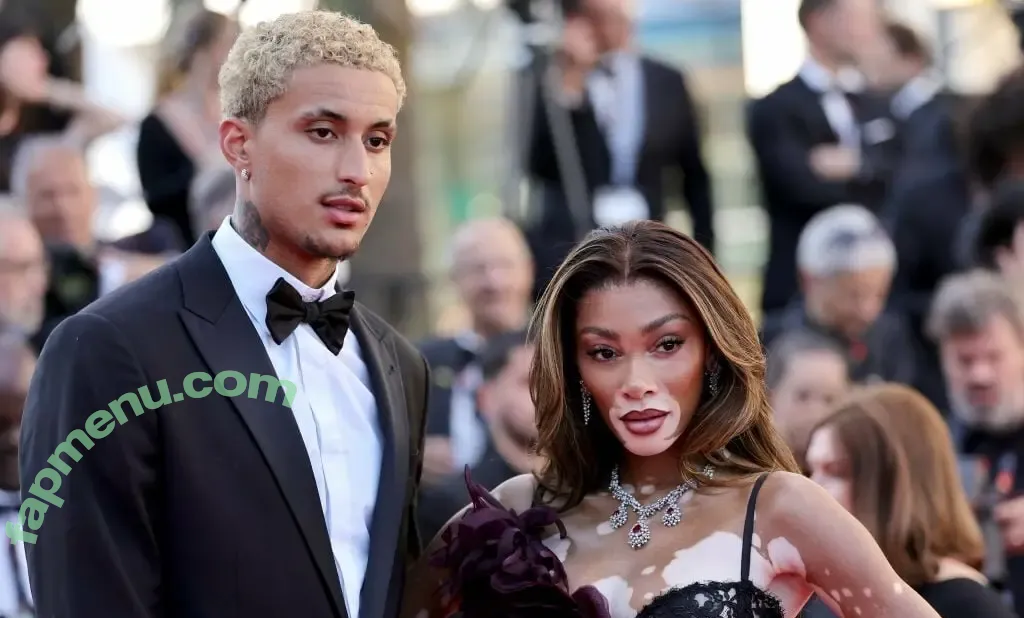 Winnie Harlow nude photo #0585 (winnieharlow)