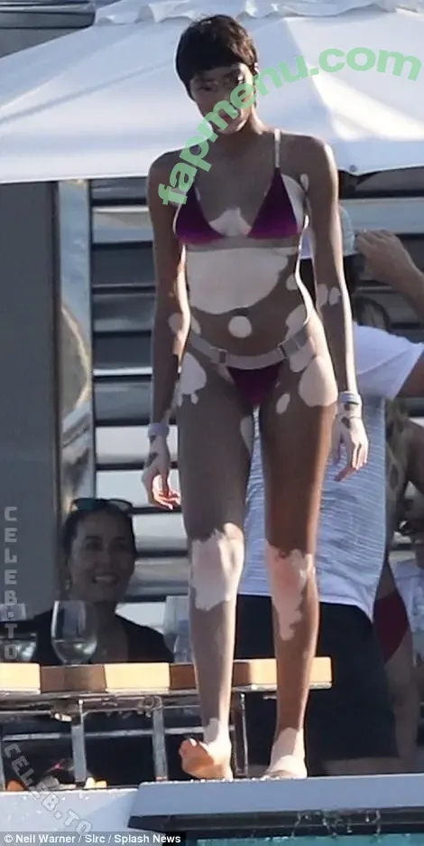 Winnie Harlow nude photo #0589 (officialwinnieharlow / winnieharlow)