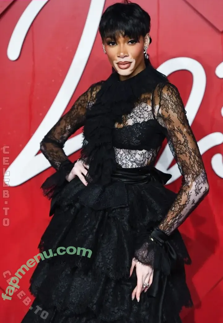 Winnie Harlow nude photo #0611 (officialwinnieharlow / winnieharlow)