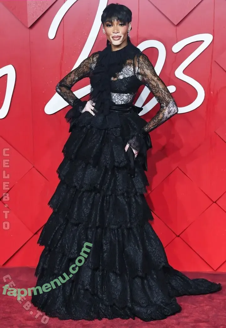 Winnie Harlow nude photo #0612 (officialwinnieharlow / winnieharlow)